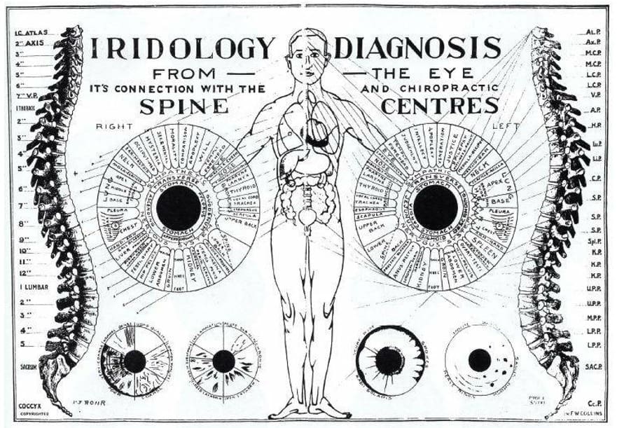 iridologija iridodiagnostika veidotyra